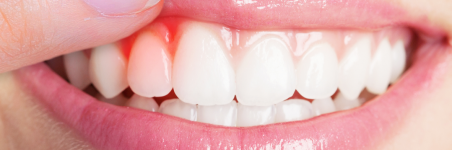 又上火又怕冷？上熱下寒、水火不濟(jì)，教你調(diào)回來(lái)！