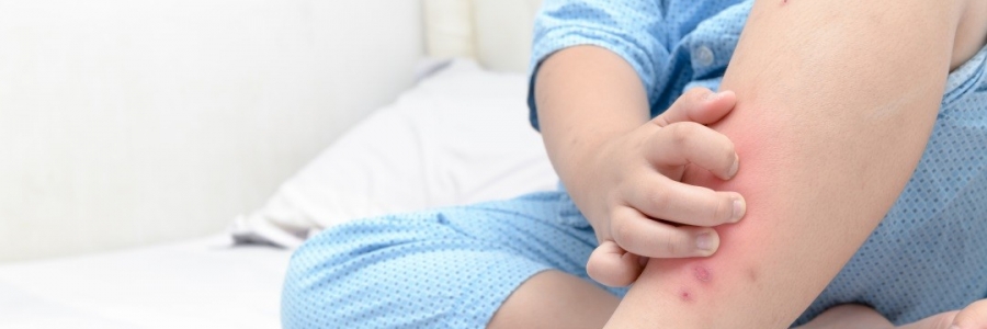 學(xué)古人這樣驅(qū)蚊，從此不再“蚊”風(fēng)喪膽！