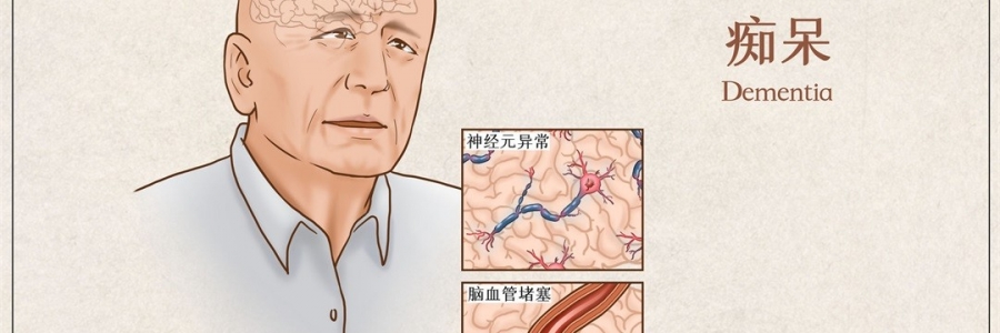 “馬什么梅？”年紀(jì)輕輕老忘事，竟是癡呆的前兆？！