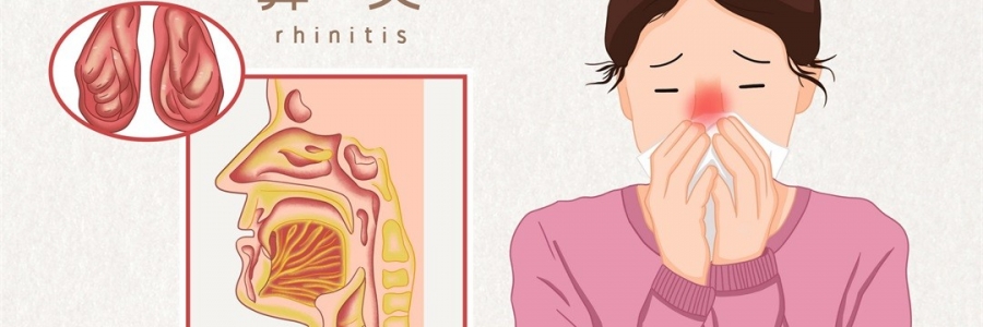 總是“水泥封鼻”？三個穴位幫你快速疏通！