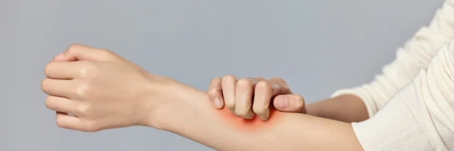 濕疹、瘙癢、蕁麻疹……患皮膚病，也許是好事！